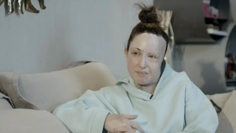 Ιωάννα Παλιοσπύρου: Αποχαιρέτησε τη μάσκα και επέστρεψε στο σημείο που της άλλαξε τη ζωή!- «Αν την ώρα της επίθεσης άνοιγα το στόμα μου θα είχε καεί ο οισοφάγος μου»