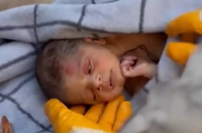 Σοκαριστικό βίντεο από την Τουρκία: Νεογέννητο διασώζεται κρατώντας μία τούφα από τα μαλλιά της μητέρας του