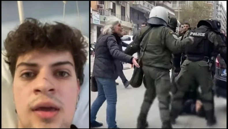 Καταγγελία για αστυνομική βία στην πορεία για τα Τέμπη: «Μου έριξε κουτουλιά με το κράνος» (VIDEO)
